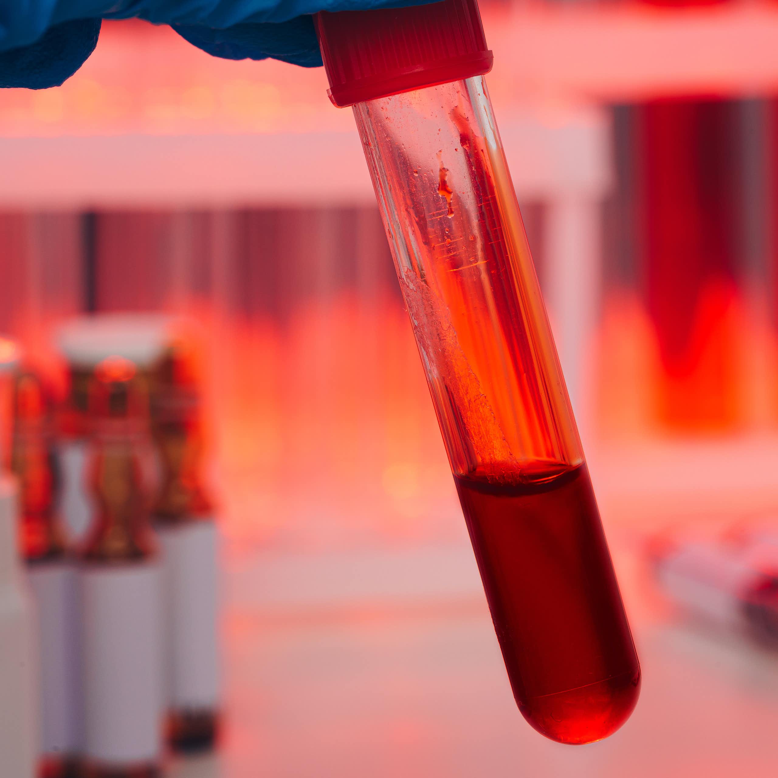 Photo of a gloved hand holding a test tube half full of blood.