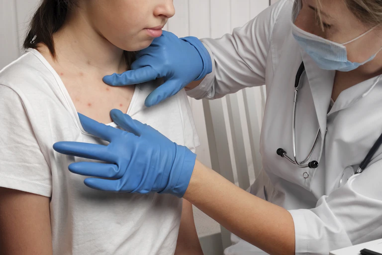 A doctor in gloves and a mask checks a rash on a child's neck and chest.