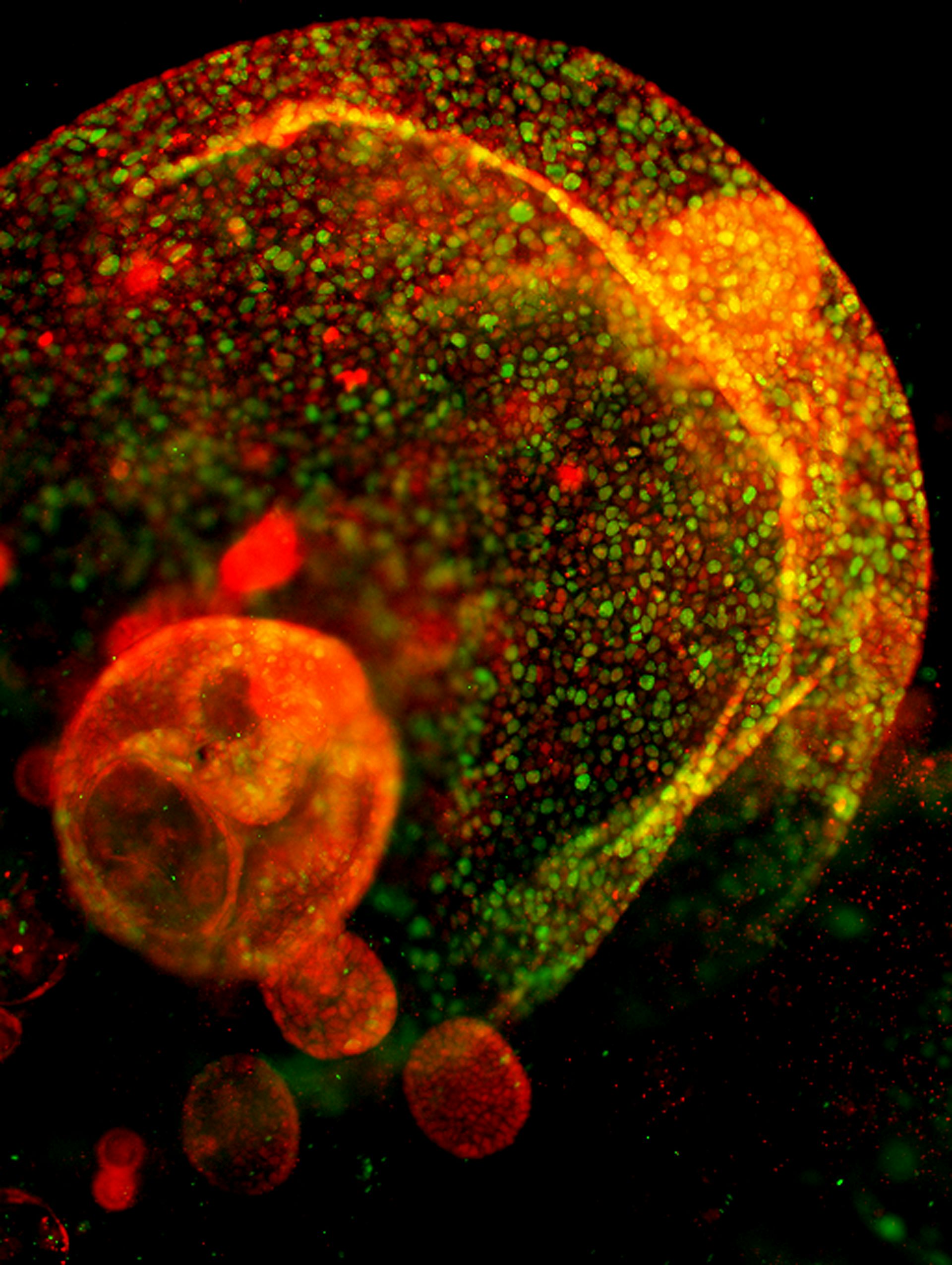 Una imagen naranja y verde de células ductales pancreáticas de ratón vistas a través de un microscopio.