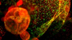 Una imagen naranja y verde de células ductales pancreáticas de ratón vistas a través de un microscopio.