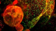 An orange and green coloured image of mouse pancreatic ductal cells viewed through a microscope.