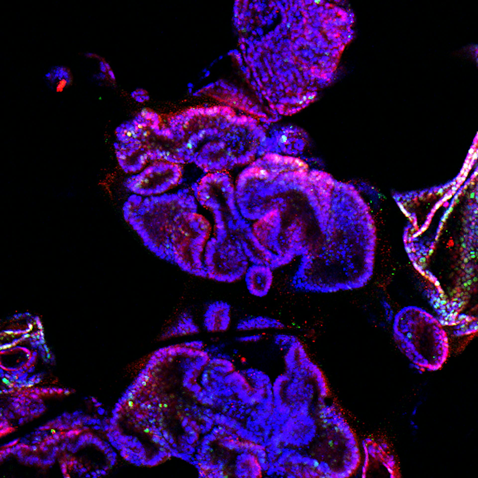 Imagen de organoides púrpuras tridimensionales generados a partir de células epiteliales del conducto pancreático de ratón.