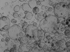 Grey-coloured image of organoids formed from human pancreatic ductal epithelial cells, viewed through a microscope.