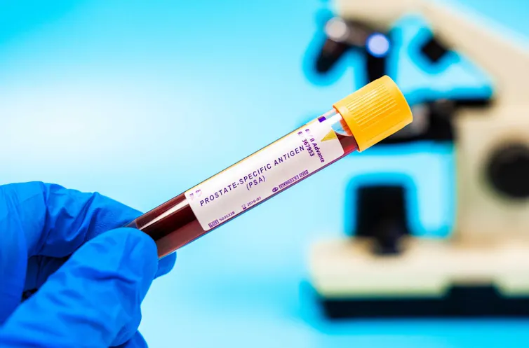 A gloved hand holding a phial of blood.