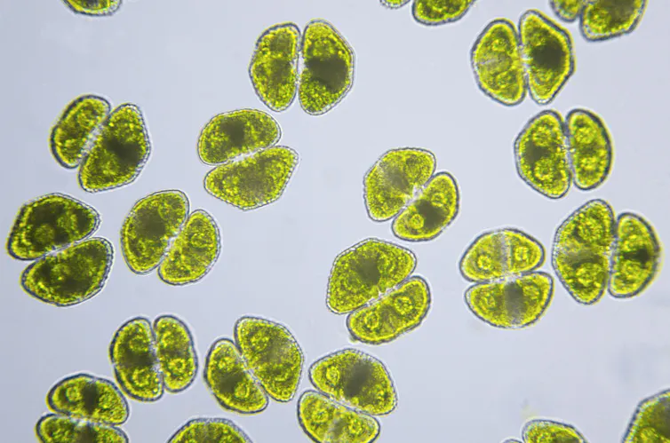 Magnified image of algae that look like little green blobs with two halves