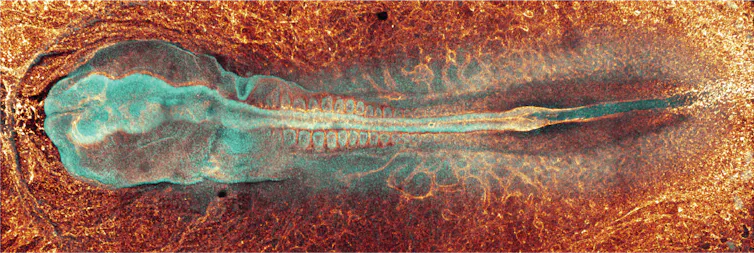 An embryo coloured in fluorescent blue and orange.