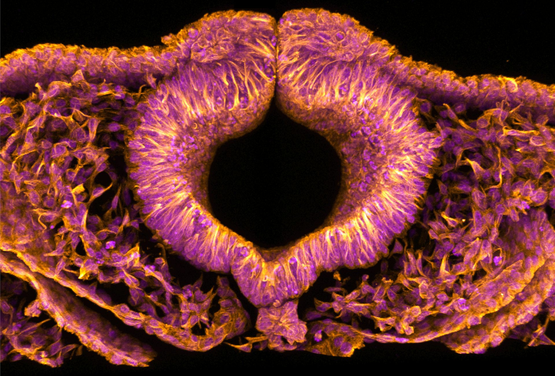 Fluorescent quail embryos could help solve serious birth defects in humans