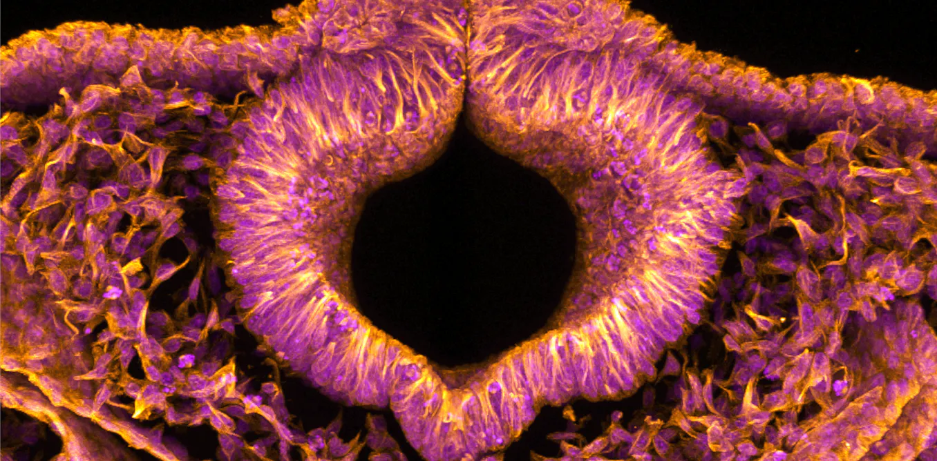 Fluorescent quail embryos could help solve serious birth defects in humans