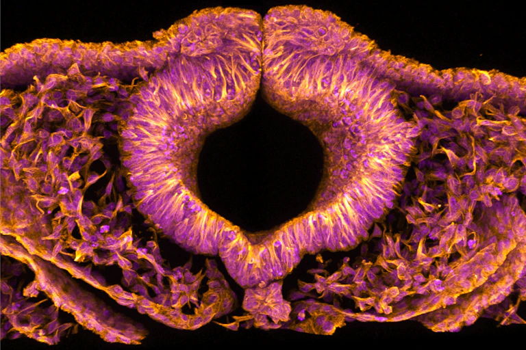 A fluorescent pink and orange microscopic image with a black hole at its centre.