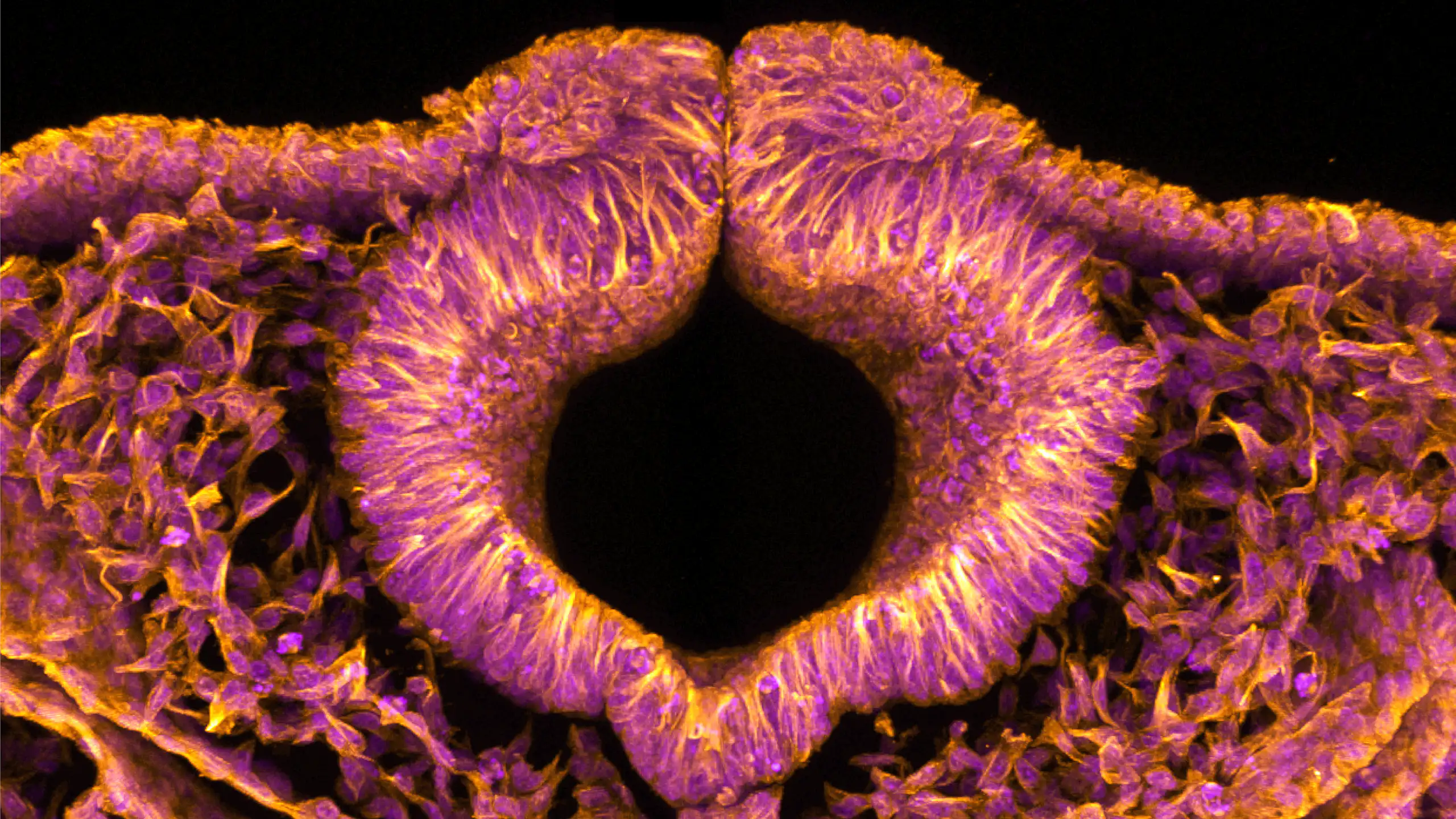 A fluorescent pink and orange microscopic image with a black hole at its centre.