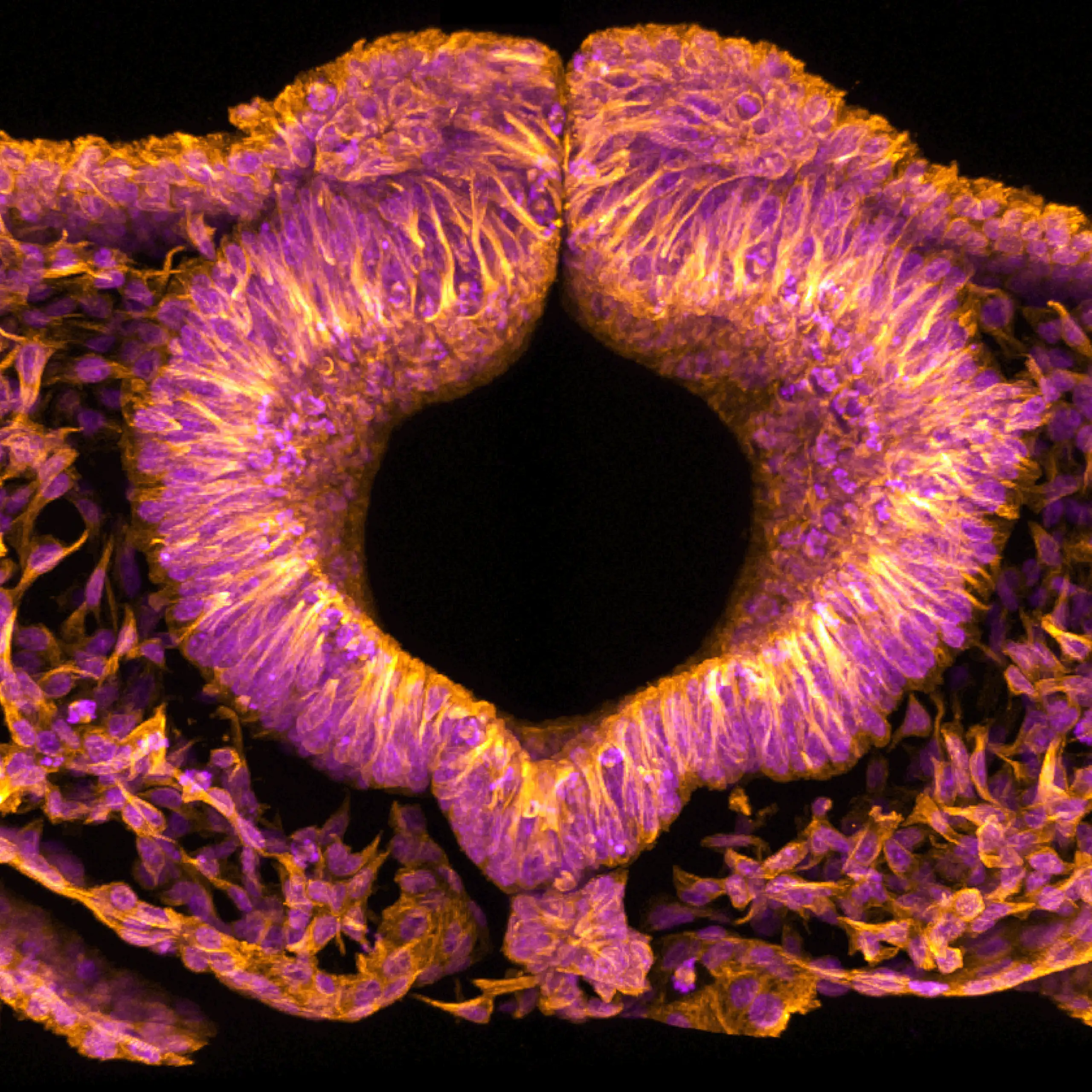 A fluorescent pink and orange microscopic image with a black hole at its centre.