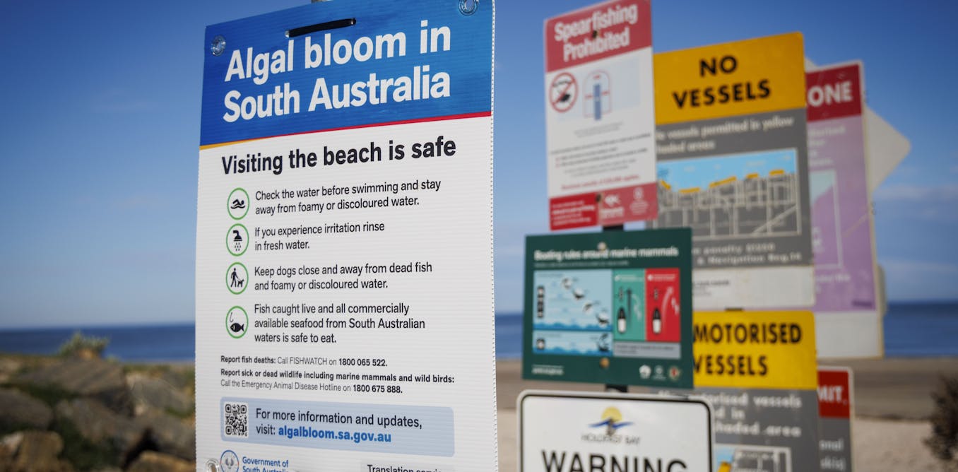 Microscopic view of Karenia brevis algae cells