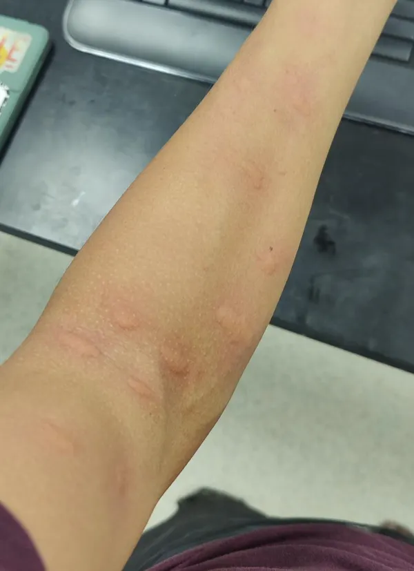 This image has been removed. For security reasons, only images from the local domain are allowed. Image removed.