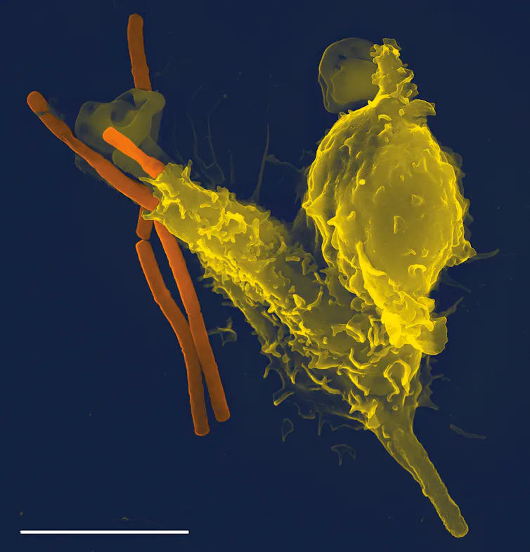 Microscopy image of two or three long, thin orange rods being swallowed by two yellow blobs