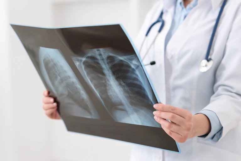 Médico olhando uma radiografia pulmonar