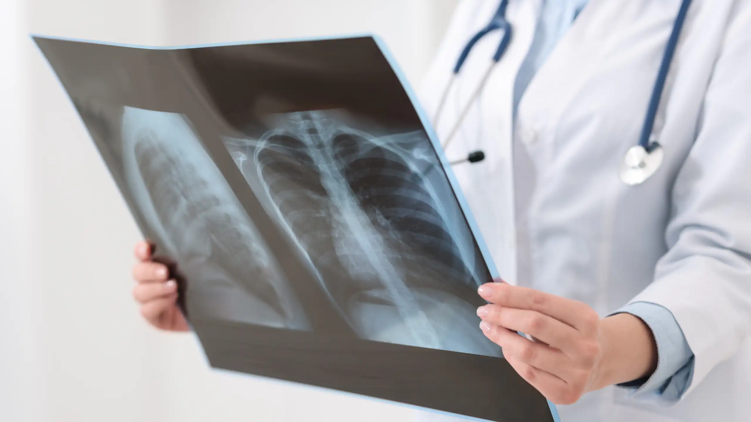 Médico olhando uma radiografia pulmonar