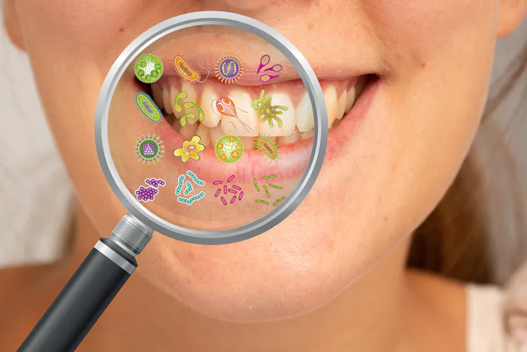 A woman smiles with her teeth. A magnifying glass is held in front of her teeth, depicting the many small microbes and bacteria that may be living inside her mouth..