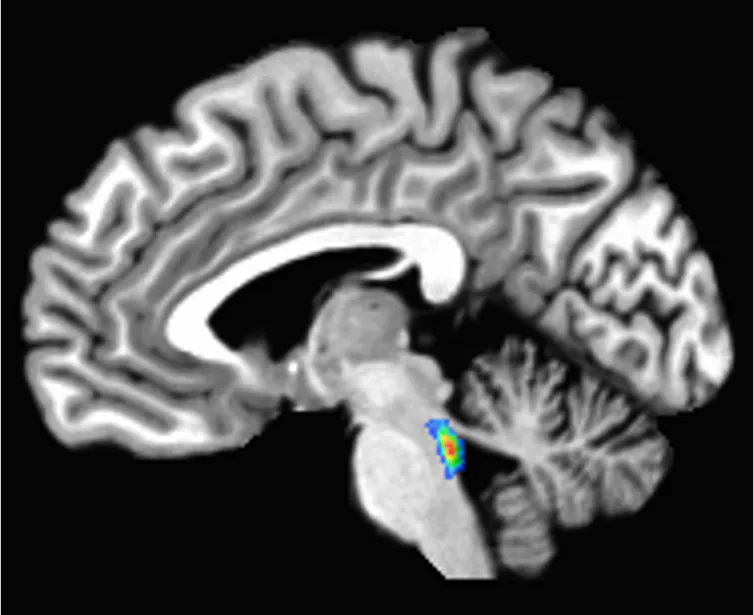 Exploración cerebral con el locus coeruleus iluminado en el tronco del encéfalo