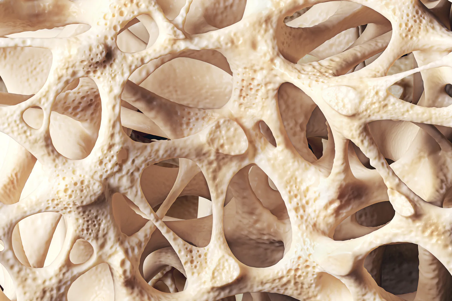 Osteopenia Tibia Osteopenia: loss of bone mineral density affects millions of people ...