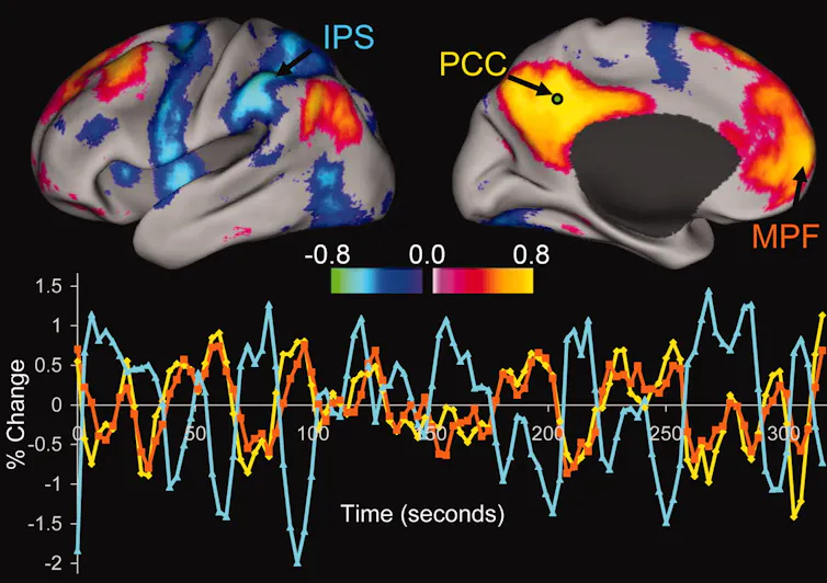 Brain scans showing variations in activity during attention-demanding cognitive tasks.