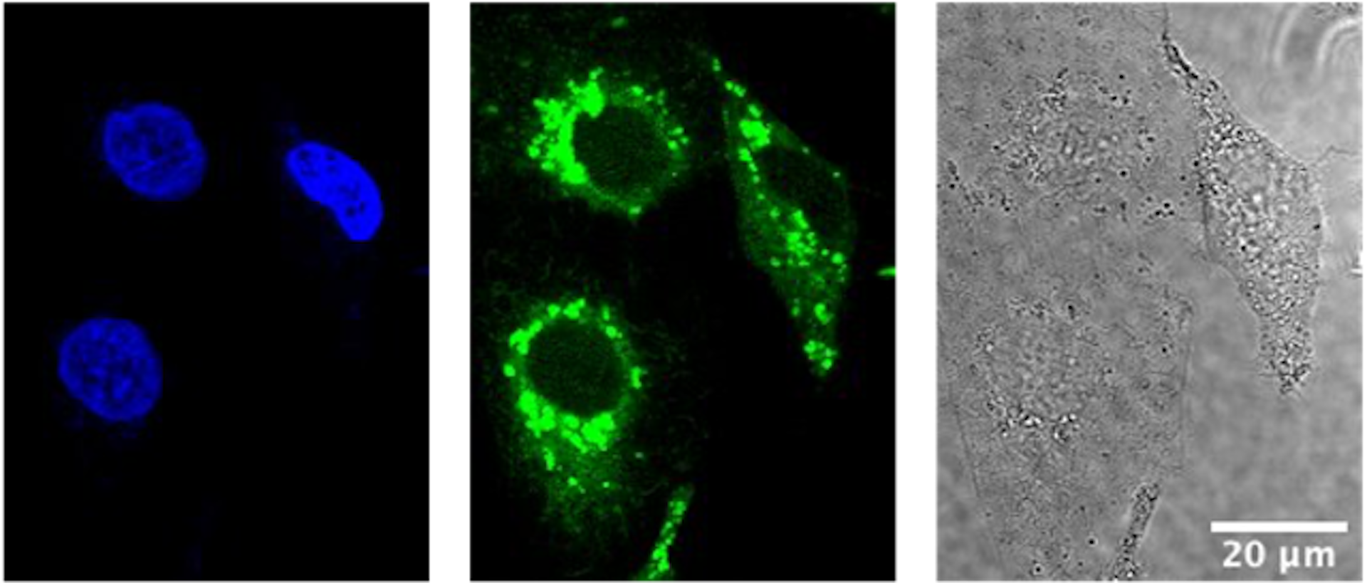 Una serie de tres imágenes: óvalos de color azul claro sobre un fondo negro, iluminación verde sobre un fondo negro, una imagen en blanco y negro de un patrón de células.