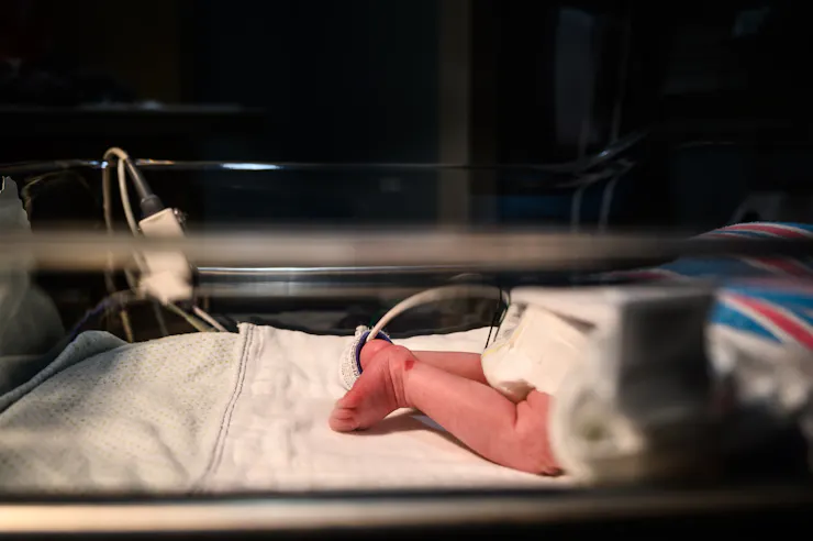 Newborn baby lying face down with monitors attached in a hospital bed.