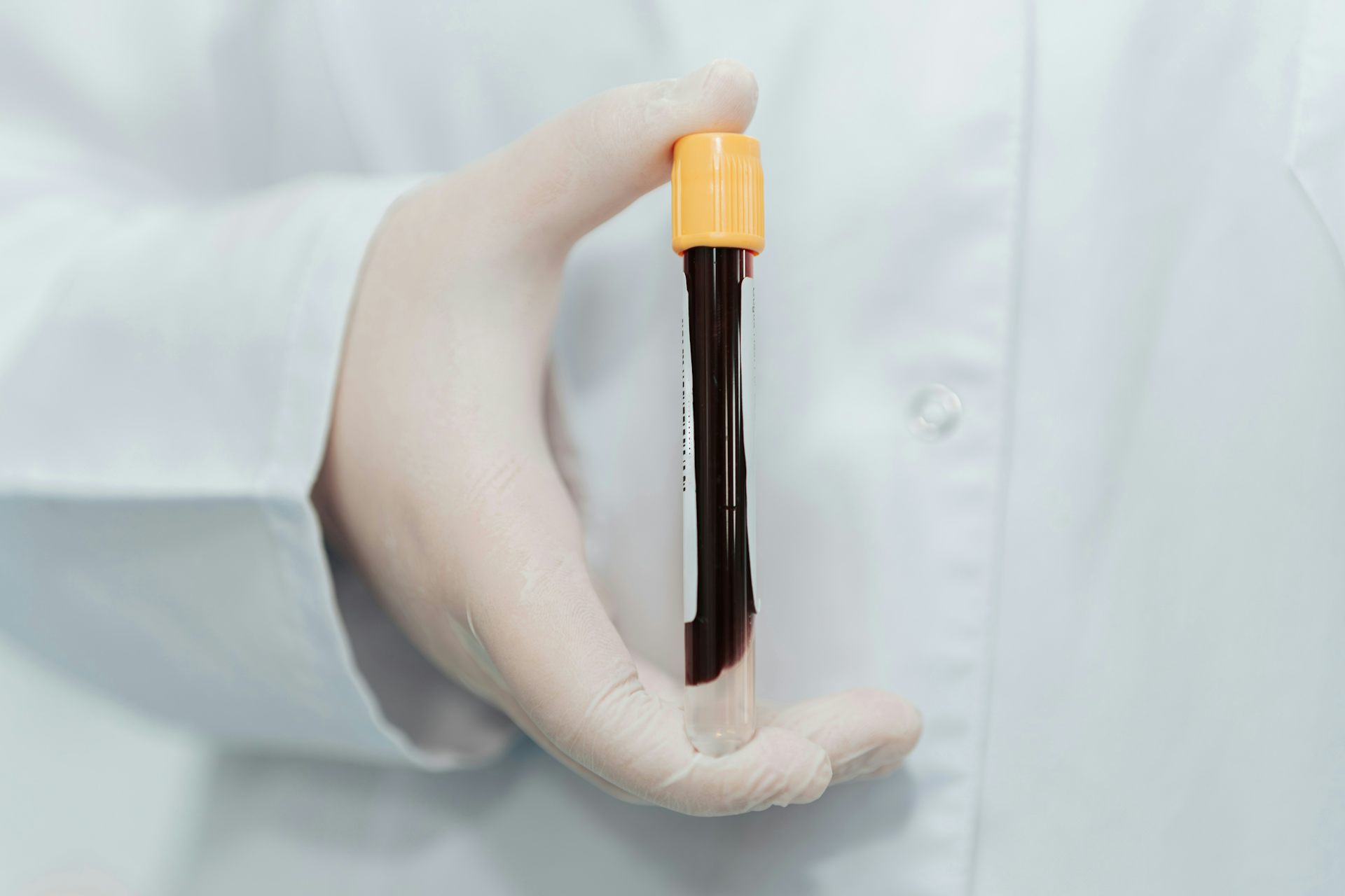 Une simple prise de sang pour traquer le cancer