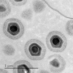 Microscopic view of a giant virus