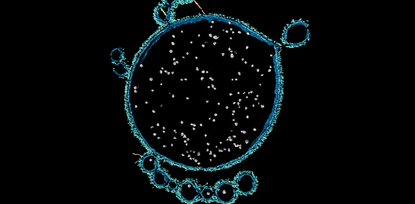 ‘First contact’ that may have led to complex life on Earth finally witnessed by scientists