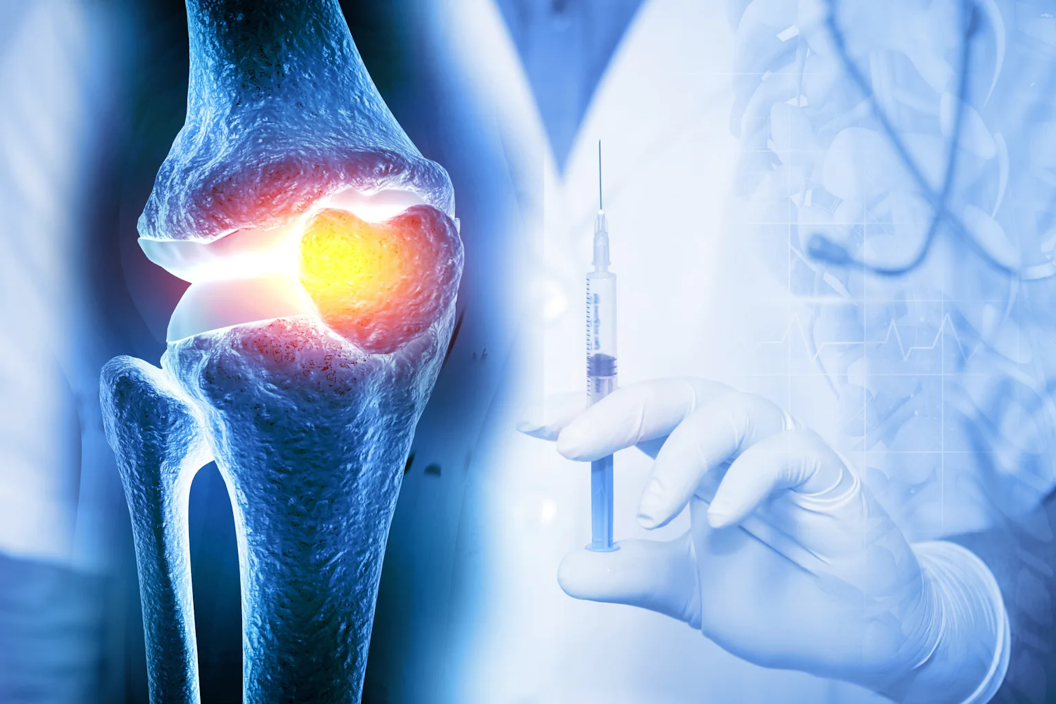 St Injection Steroid injections for joint pain: everything you need to know about ...