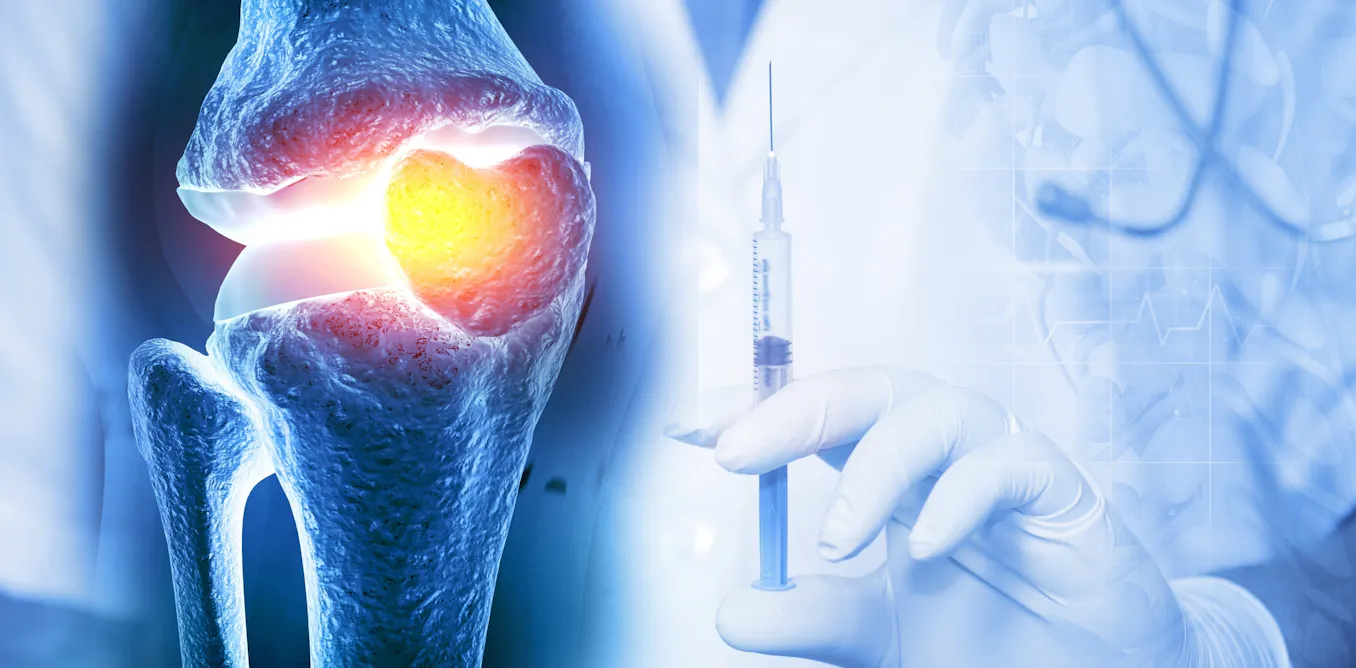 Large Joint Injection Rvu Steroid injections for joint pain: everything you need to know about ...