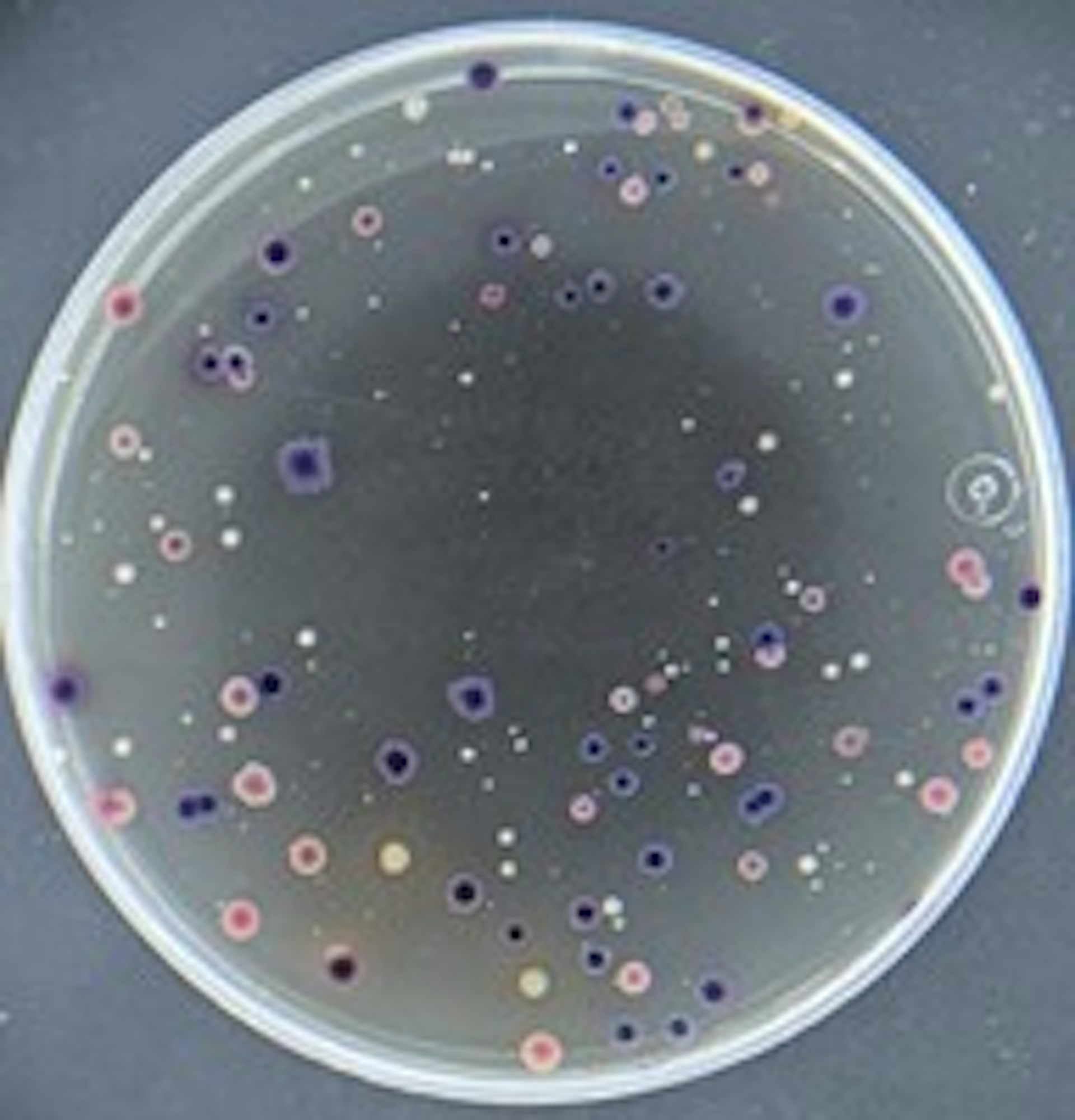 Placa de Petri con manchas de colores.