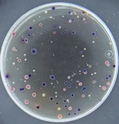 El cambio climático favorece el crecimiento de microorganismos patógenos que pueden llegar a nuestros grifos 1 Placa de Petri con manchas de colores.