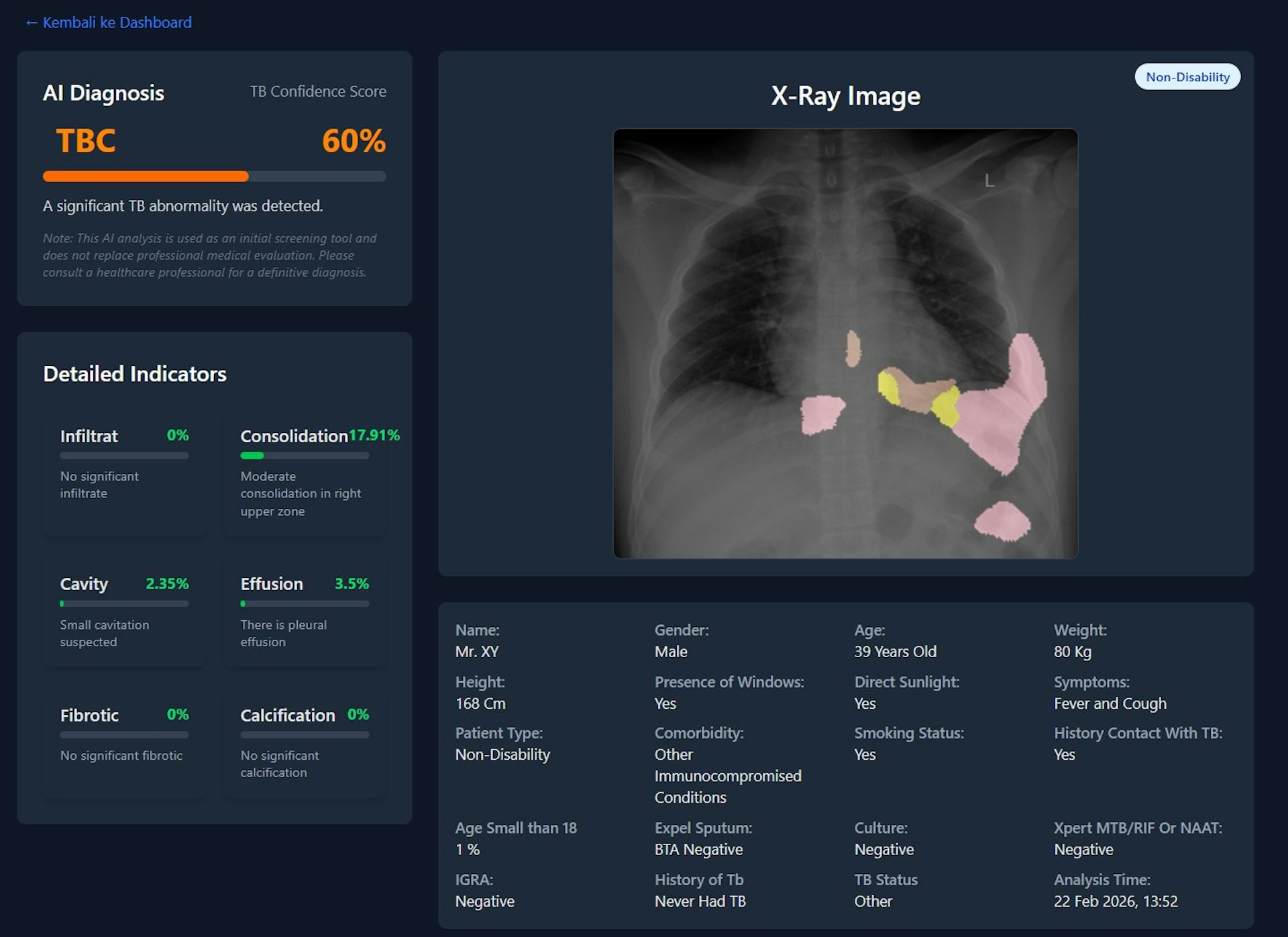 Hasil screening TB pakai CAD AI.