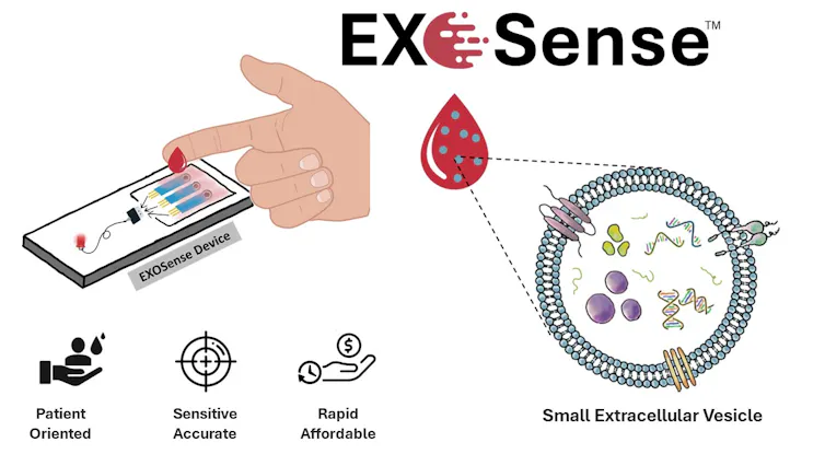 Una nueva prueba promete detectar el cáncer antes, a partir de pequeñas partículas en los fluidos corporales 2 file 20260419 57 y63fe5.jpg?ixlib=rb 4.1