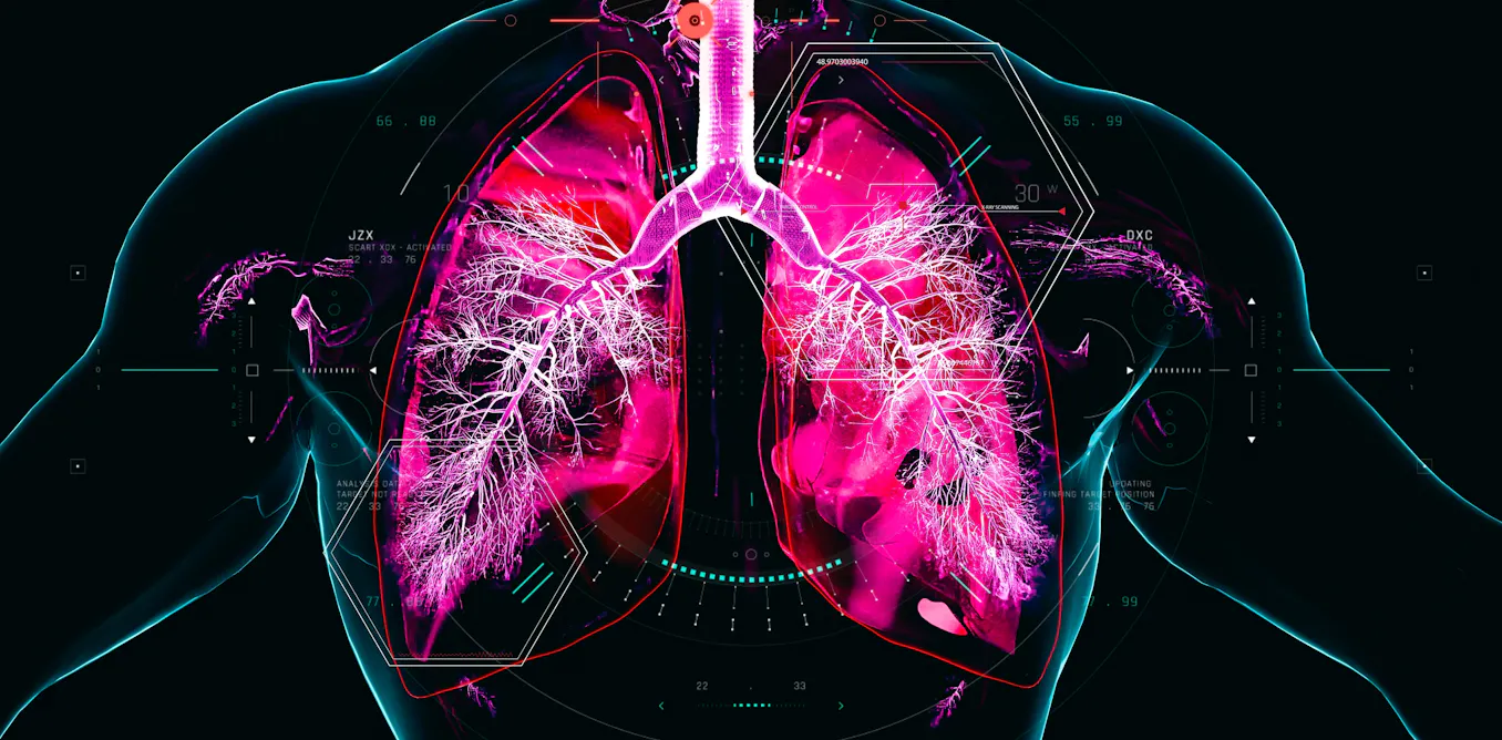 Chronic obstructive pulmonary disease develops over decades – and we are missing the window to prevent it