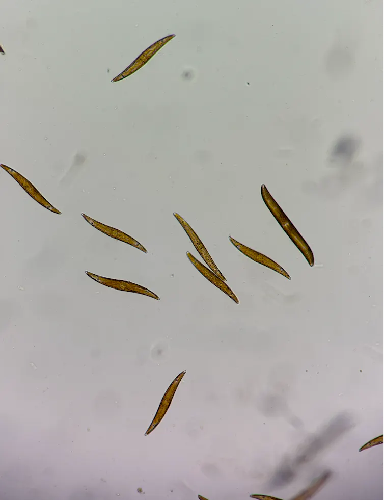 Oxygen, this paradoxical molecule, the foundation of existence and a dangerous poison: how microorganisms take care of it 1 file 20260424 71 h3fx9k.png?ixlib=rb 4.1