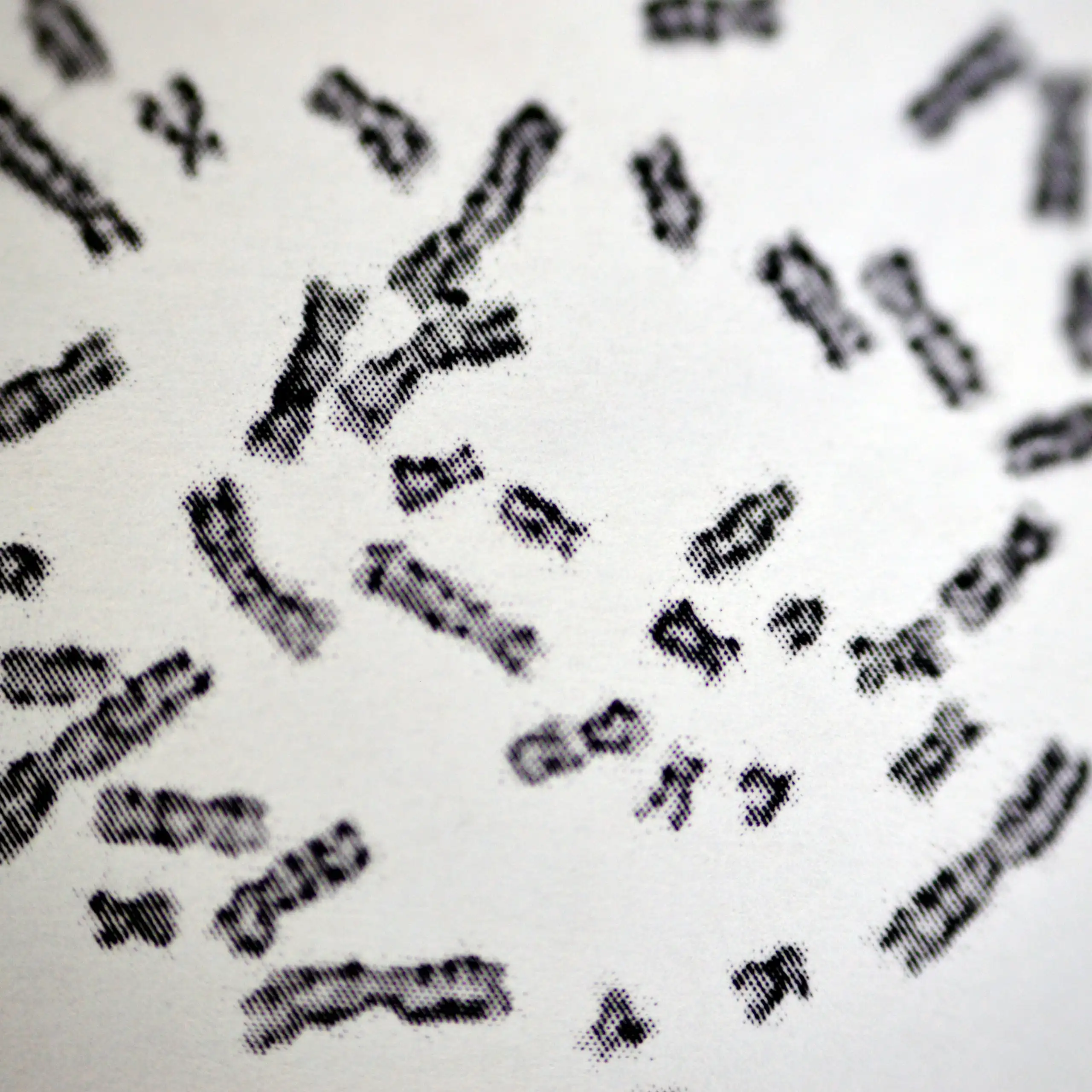 Caryotype présentant des chromosomes humains