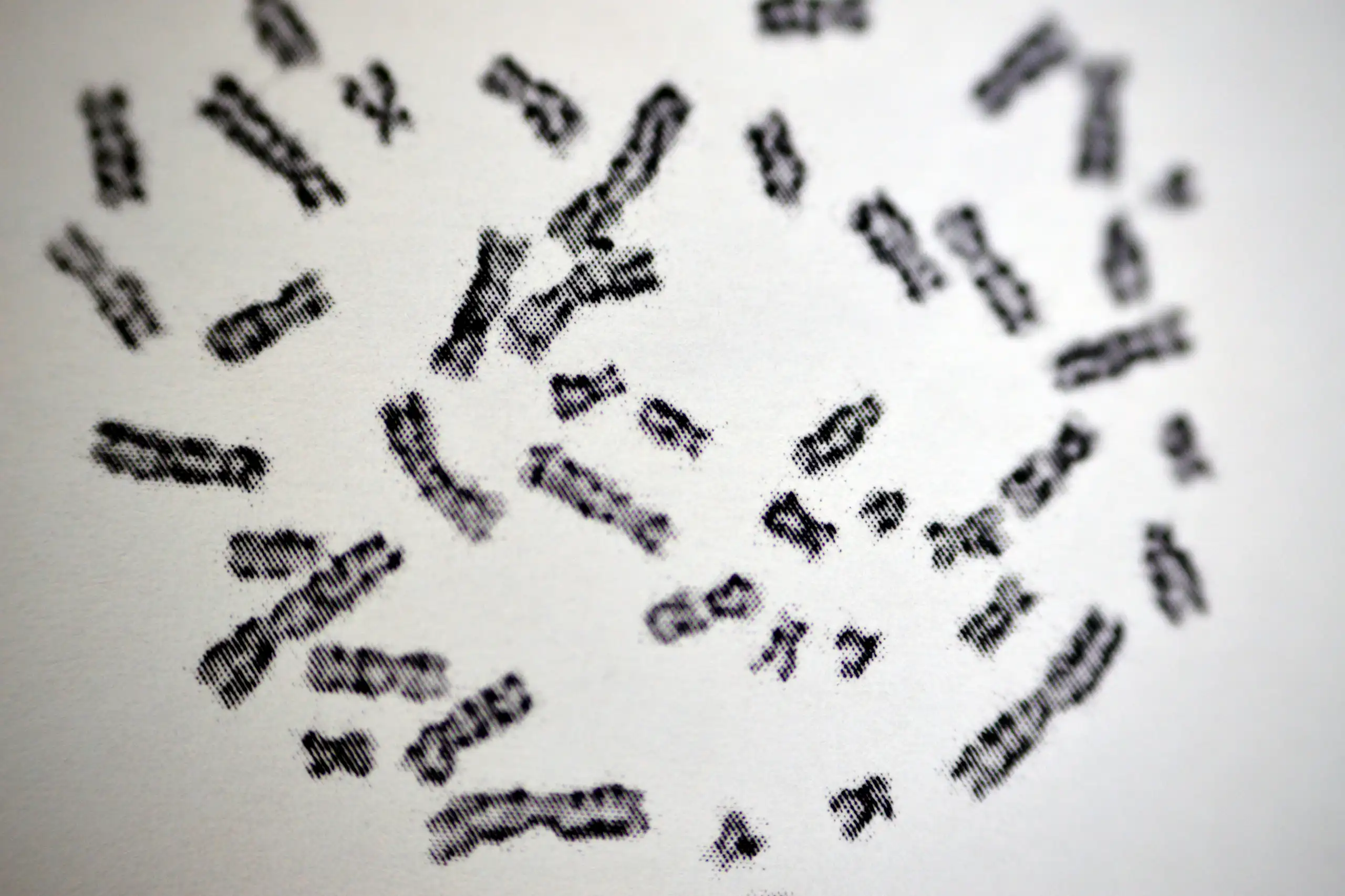 Caryotype présentant des chromosomes humains