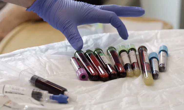 A hand in blue medical gloves reaching for blood samples in test tubes.
