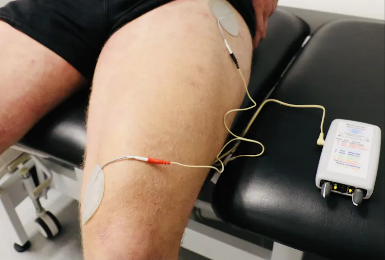 Electrical muscle stimulation electrodes applied to the thigh.