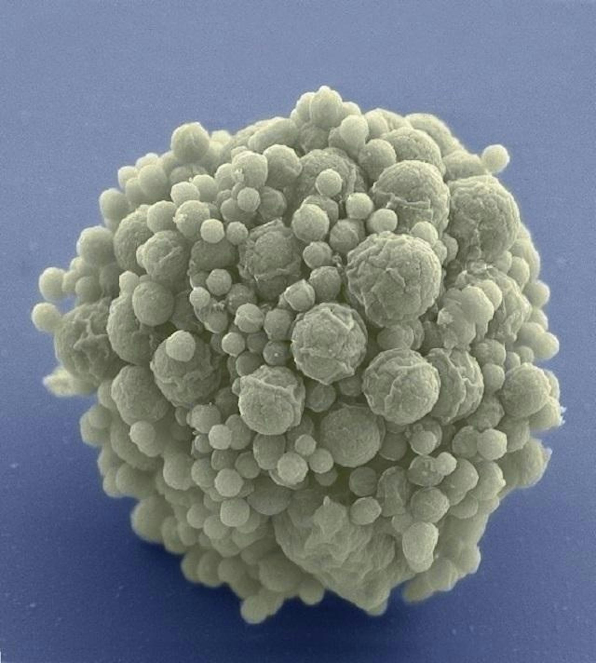Microscopy image of a grey spherical blob with a rough surface of spherical protuberances