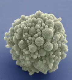 Microscopy image of a grey spherical blob with a rough surface of spherical protuberances