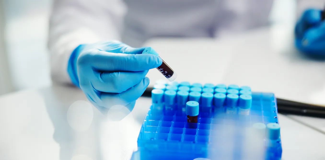 Researchers increase African representation in genomic databases