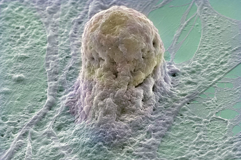 A pale yellowish cell on a pale green and white matrix