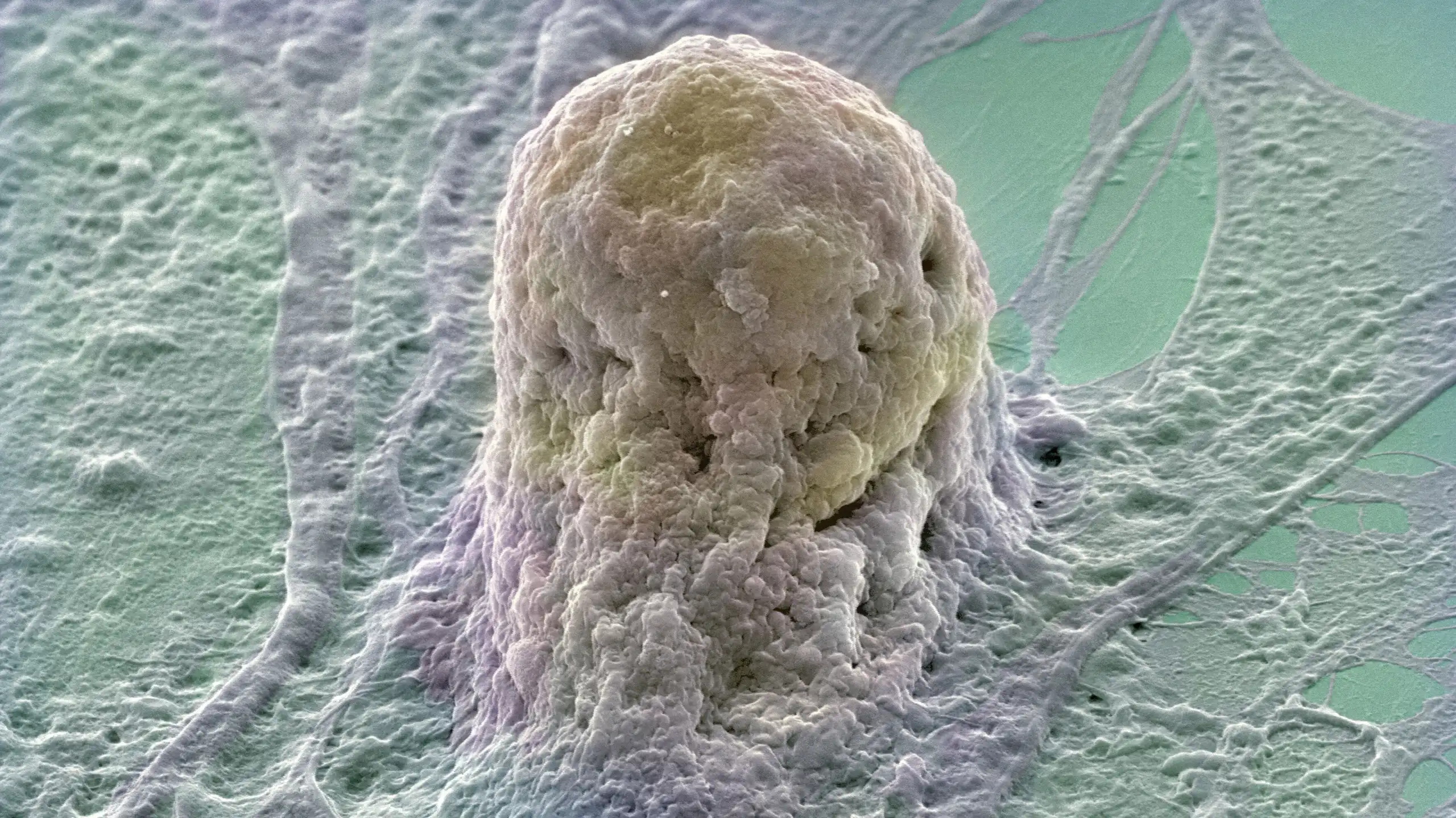 A pale yellowish cell on a pale green and white matrix