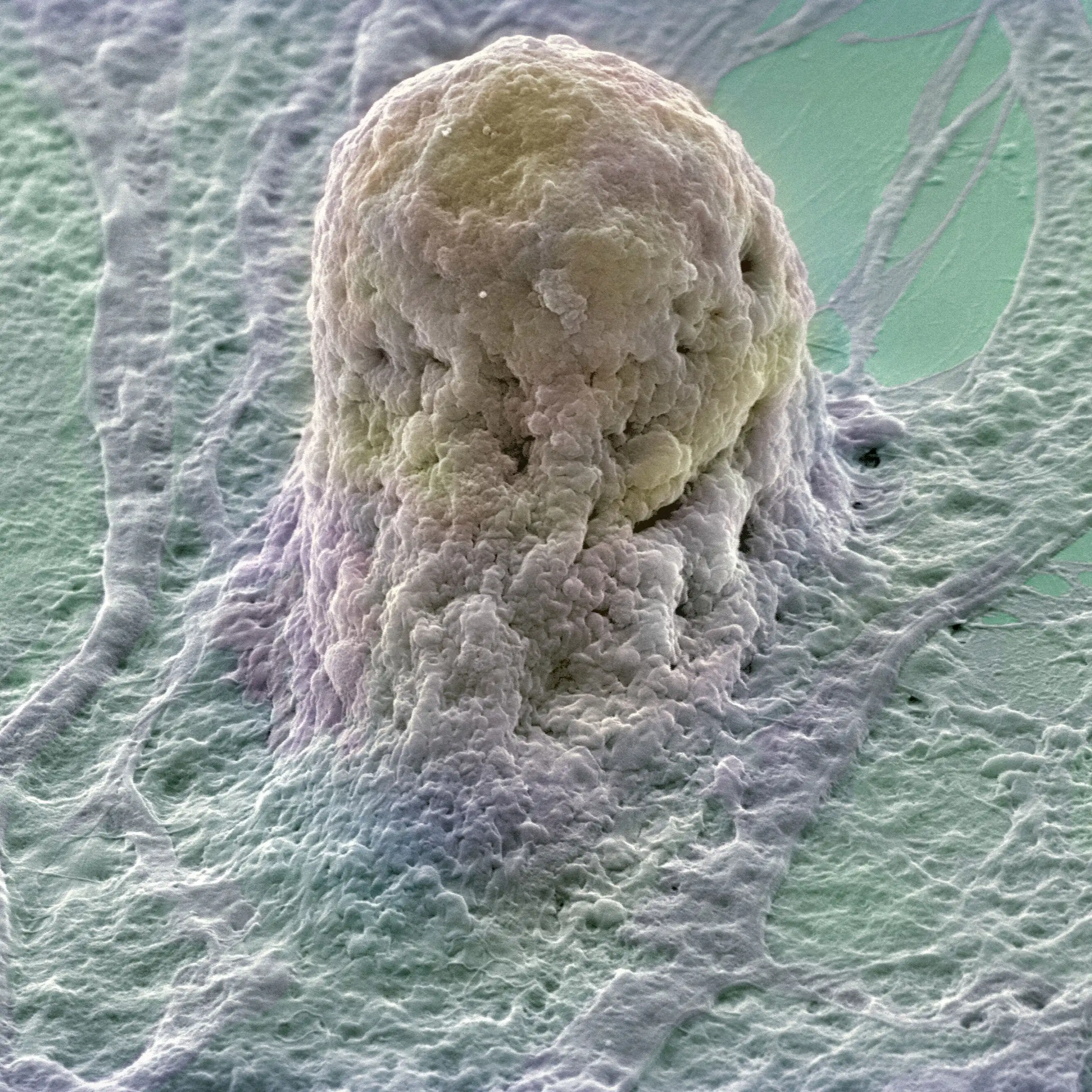 A pale yellowish cell on a pale green and white matrix