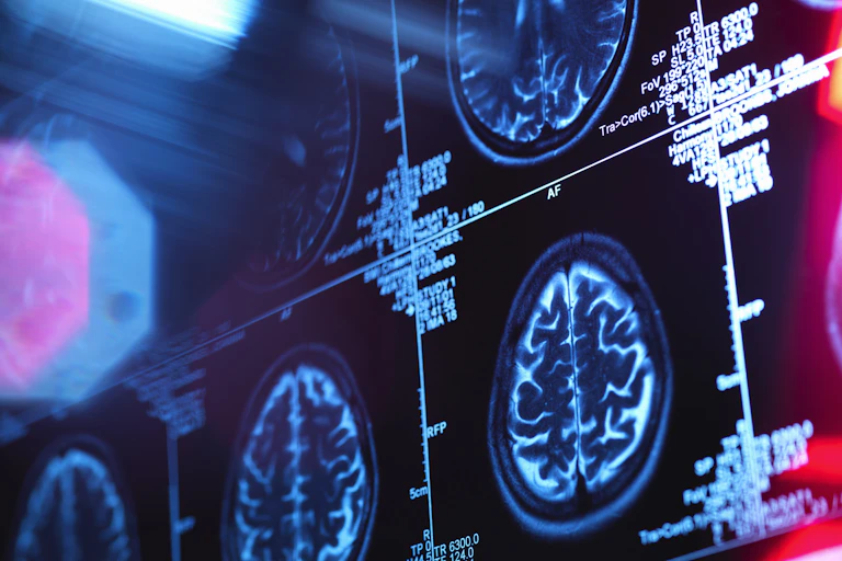Brain scans, with a fading edge of the image