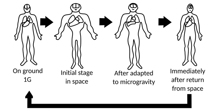 A diagram showing 4 drawings of a person, translucent so you can see their organs. In the first, 1G, the person is standing normally. In the 2nd, initial spaceflight, the person's upper body swells while their lower body is more shriveled. In the 3rd, adaptation to spaceflight they're more returned to normal, but still with some upper body swelling. In the 4th, return to Earth, they are back to normal