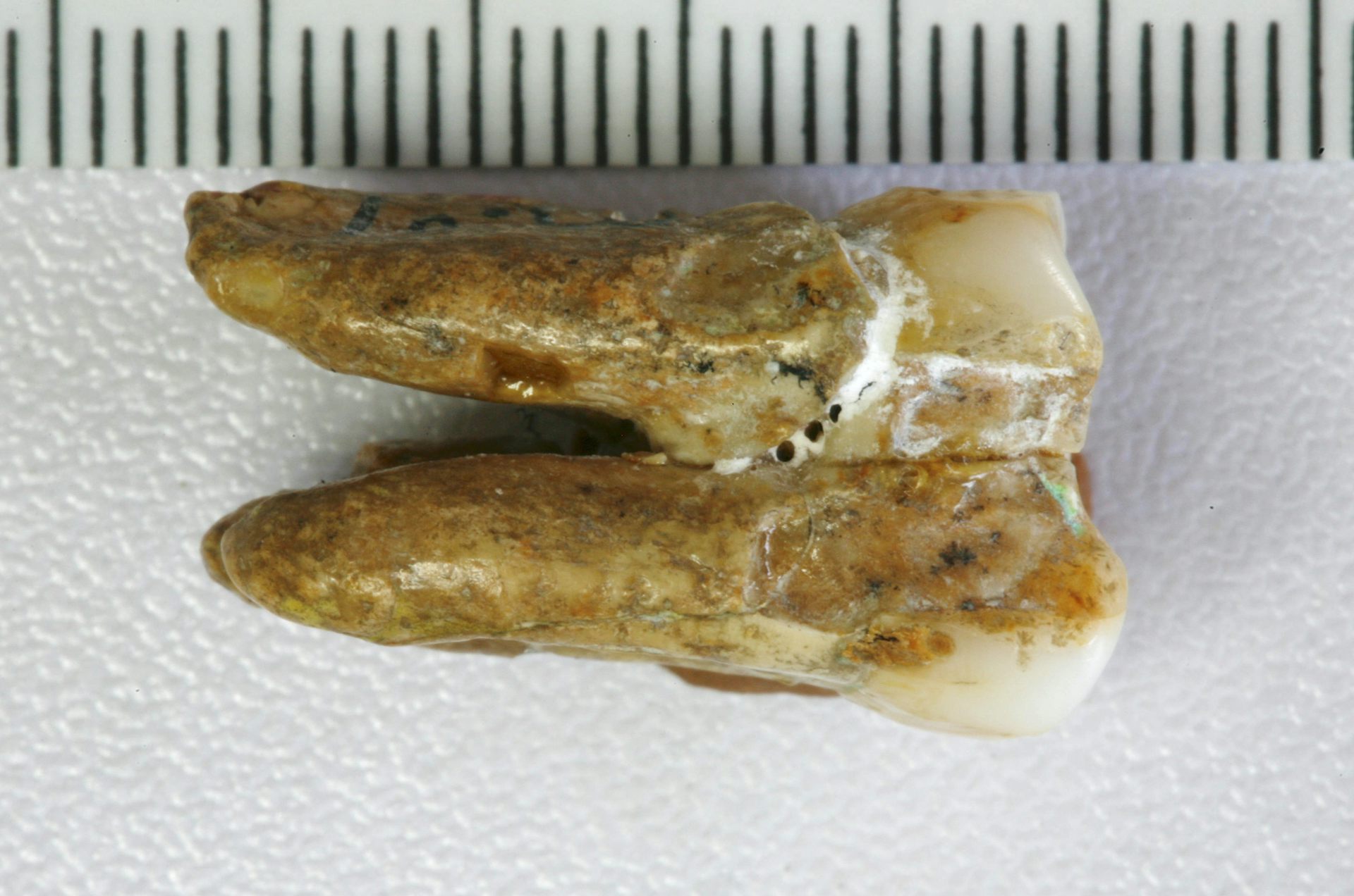 A tooth from the Zhoukoudian site that was used in the analysis.